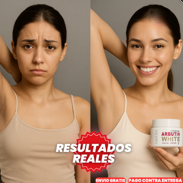 ArbutinWhite™ X2 Crema Blanqueadora De Arbutina