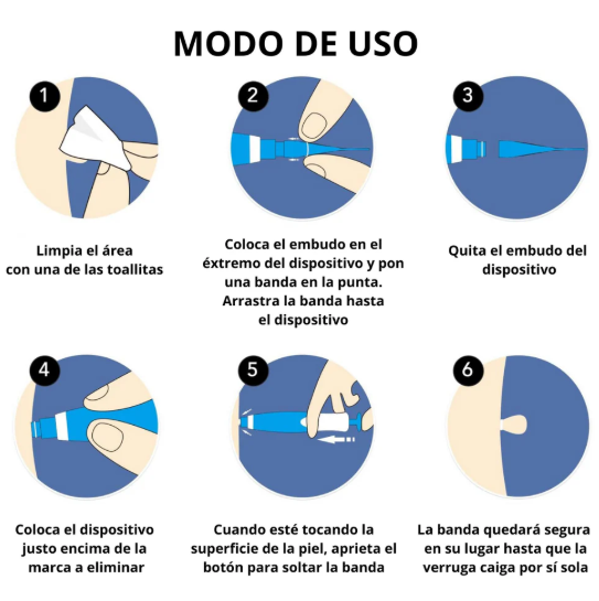 REMOVEDOR DE VERRUGAS +OBSEQUIO GRATIS CREMA DE ABEJA🧴🐝
