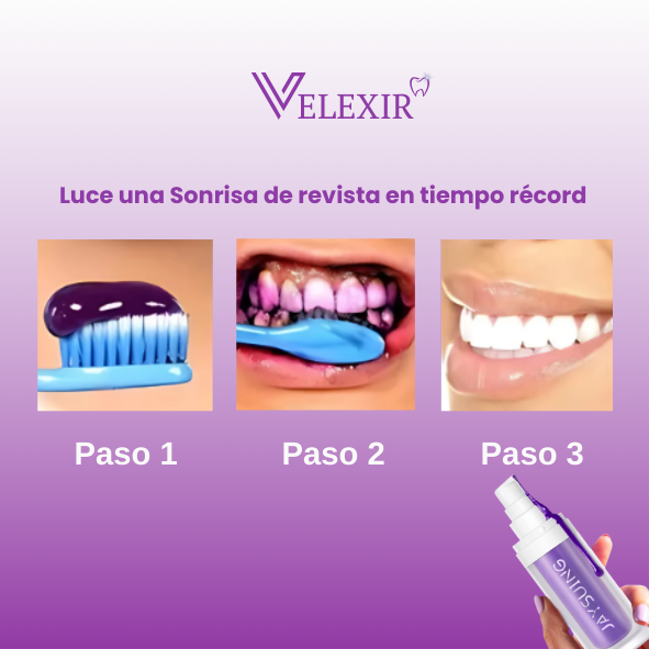 Magic White® | Blanqueador Dental V34