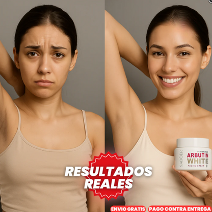 ArbutinWhite™ X2 Crema Blanqueadora De Arbutina