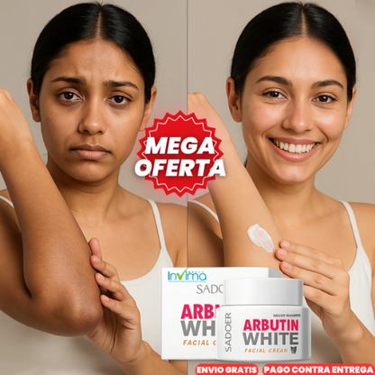 ArbutinWhite™ X2 Crema Blanqueadora De Arbutina